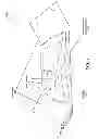 Fig. 03 - Enhanced patient-orienting alternating pressure support apparatus