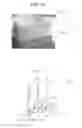 Fig. 10 - FLOW DIVERTERS TO ENHANCE HEAT SINK PERFORMANCE