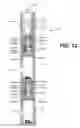 Fig. 12 - Pressure-activated switch