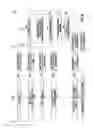 Fig. 07 - PRESSURE CONTROL IN DRILLING OPERATIONS WITH OFFSET APPLIED IN RESPONSE TO PREDETERMINED CONDITIONS