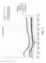 Fig. 08 - System and method for measuring and treating a liquid stream