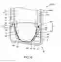 Fig. 11 - Medical instrument