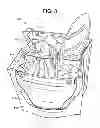 Fig. 04 - Reusable and disposable grocery bags