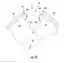 Fig. 03 - Injection-molded composite construct