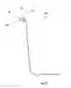 Fig. 21 - Injection-molded composite construct