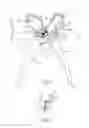 Fig. 04 - Hand-Actuated Fluid Delivery Device