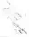 Fig. 06 - Surgical instrument system configured to evaluate the load applied to a firing member at the initiation of a firing stroke