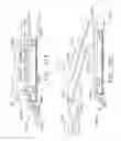 Fig. 191 - Fastener cartridge comprising a tissue thickness compensator including openings therein