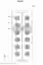 Fig. 91 - RFID tag, RFID system, and package including RFID tag