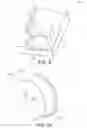 Fig. 08 - Cup-shaped nozzle assembly with integral filter structure