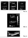 Fig. 09 - Magnetic resonance imaging method for the quantification of the Tand/or Trelaxation times in a sample