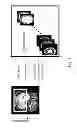 Fig. 02 - Method and apparatus for 3D magnetic resonance imaging