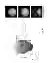 Fig. 09 - Method and apparatus for 3D magnetic resonance imaging