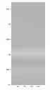 Fig. 01 - Borehole log data processing methods