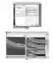 Fig. 05 - User interface for acquisition, display and analysis of ophthalmic diagnostic data