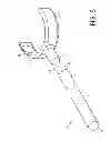 Fig. 06 - Sterile surgical headlight aperture adjusting device