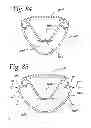 Fig. 69 - Lighting assembly