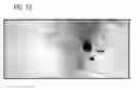 Fig. 09 - Out of plane artifact reduction in digital breast tomosynthesis and CT