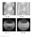 Fig. 04 - Computed tomography system with dynamic bowtie filter