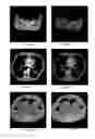 Fig. 06 - Computed tomography system with dynamic bowtie filter