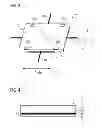 Fig. 03 - Radiography device and method for examinations in the field of pediatric radiology