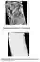 Fig. 01 - Fingerprint recognition method and electronic device thereof