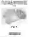 Fig. 07 - System and method to determine slide quality of a digitized microscope slide