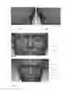 Fig. 02 - Method for designing an orthodontic appliance