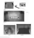 Fig. 06 - Method for designing an orthodontic appliance