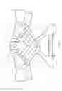 Fig. 07 - Adjustable inside applicator