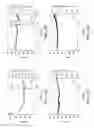 Fig. 13 - Nitric oxide delivery devices