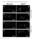Fig. 02 - METHODS FOR DIAGNOSING AND TREATING ALZHEIMER'S DISEASE BY ADMINISTERING AN ANTI-ANGIOGENIC AGENT