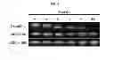 Fig. 10 - Method for nucleic acid delivery using hyaluronic acid