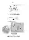 Fig. 11 - Method for nucleic acid delivery using hyaluronic acid