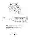 Fig. 167 - GLYCOPEGYLATION METHODS AND PROTEINS/PEPTIDES PRODUCED BY THE METHODS
