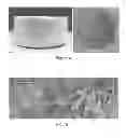 Fig. 04 - Implantable scaffolds and methods of use