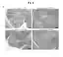 Fig. 09 - GPR15-mediated homing and uses thereof