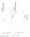 Fig. 07 - Method of analyzing the charge profile of heparan N-sulfatase