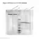 Fig. 02 - Fully human antibodies that bind to VEGFR2 and methods of use thereof