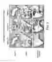 Fig. 06 - Diagnosis and treatment of chronic obstructive pulmonary disease (COPD)