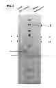 Fig. 04 - Compositions and methods for detecting, treating, and protecting against fusobacterium infection