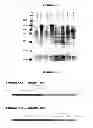Fig. 09 - HETEROLOGOUS EXPRESSION OF NEISSERIAL PROTEINS