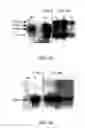 Fig. 04 - Expression of Protective Antigens in Transgenic Chloroplasts and the Production of Improved Vaccines