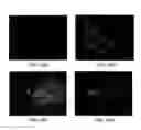 Fig. 20 - Expression of Protective Antigens in Transgenic Chloroplasts and the Production of Improved Vaccines