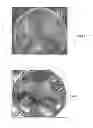 Fig. 02 - ANTIMICROBIAL TEXTILES