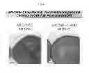 Fig. 45 - STREPTOCOCCAL GlcNAc-LACKING GLYCOPOLYPEPTIDES, CELL WALL CARBOHYDRATES, STREPTOCOCCUS VACCINES, AND METHODS FOR MAKING AND USING THEM