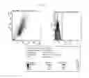 Fig. 07 - COMPOSITION FOR DELIVERY OF ANGIOGENESIS INDUCING MOLECULE AND ARTIFICIAL TISSUE PREPARED BY THE COMPOSITION