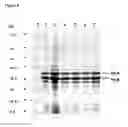 Fig. 09 - VACCINE COMPOSITION