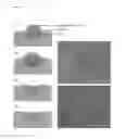 Fig. 09 - Bone pastes comprising biofunctionalized calcium phosphate cements with enhanced cell functions for bone repair