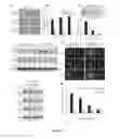 Fig. 04 - PHARMACEUTICAL COMPOSITION FOR ELIMINATION OF CANCER STEM CELLS